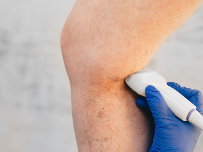 A Dra. Thaline Neves revela como o ultrassom é fundamental na detecção de insuficiências venosas e tromboses.