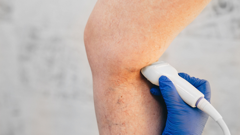 A Dra. Thaline Neves revela como o ultrassom é fundamental na detecção de insuficiências venosas e tromboses.